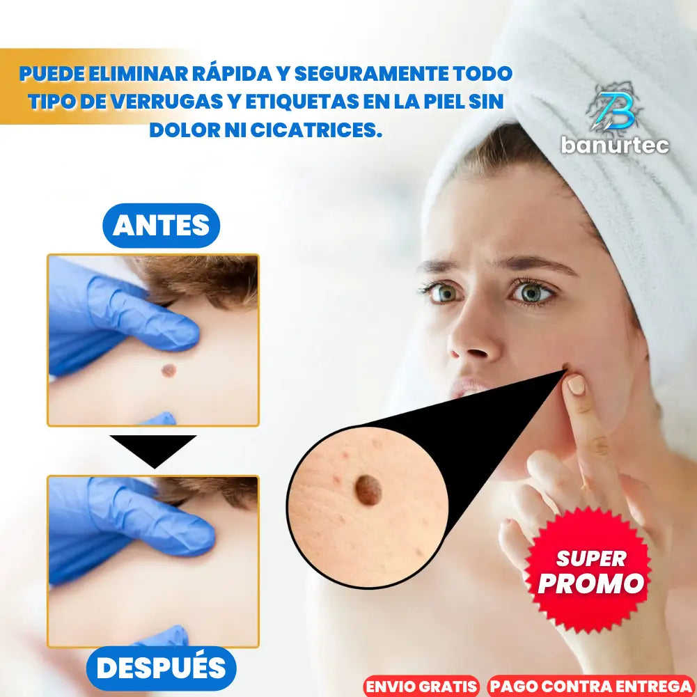 Tag Recede: Elimina Verrugas en 2 Semanas