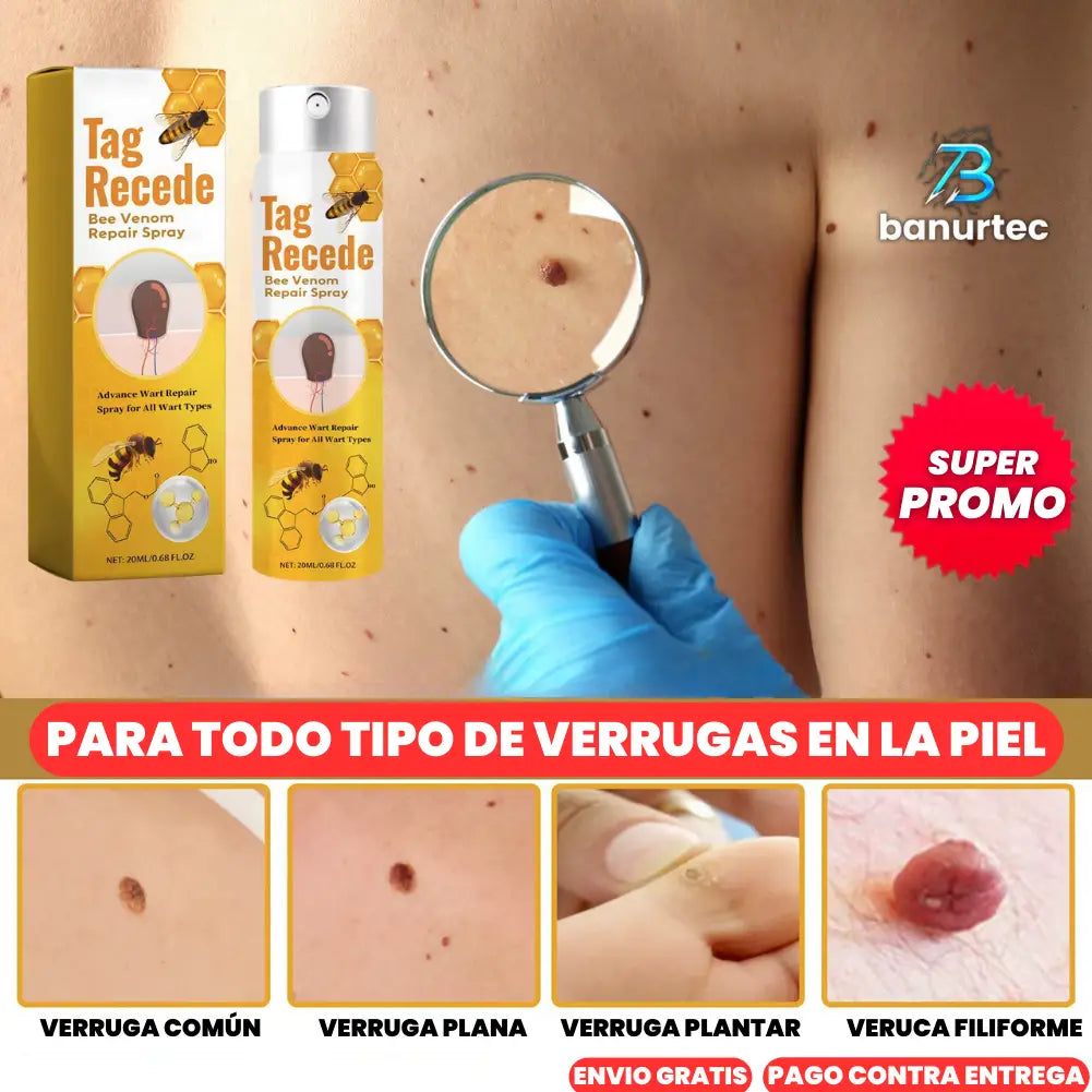 Tag Recede: Elimina Verrugas en 2 Semanas