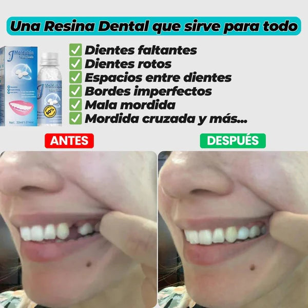 Resina Dental Moldeable: Sonrie Sin Miedo 😁
