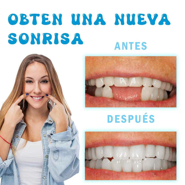 Resina Dental Moldeable: Sonrie Sin Miedo 😁